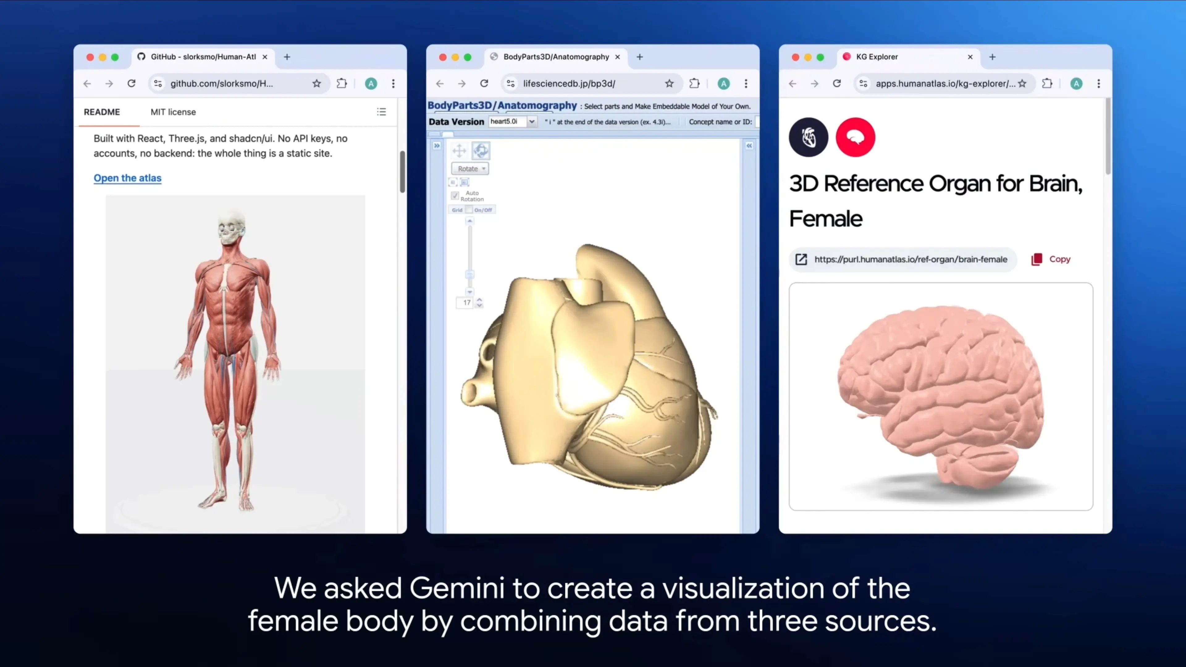 Gemini 4 Argon-3D 醫學教育